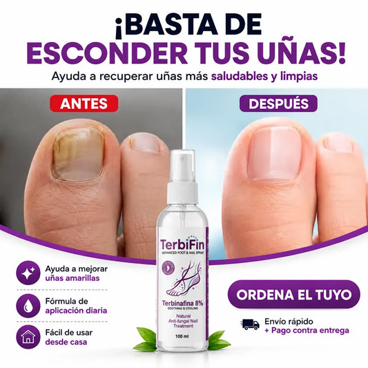 ¡Combate los hongos y dile adiós a esconder tus uñas amarillas y opacas!